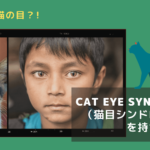 まるで猫の目？Cat Eye Syndromeをもつ人々について